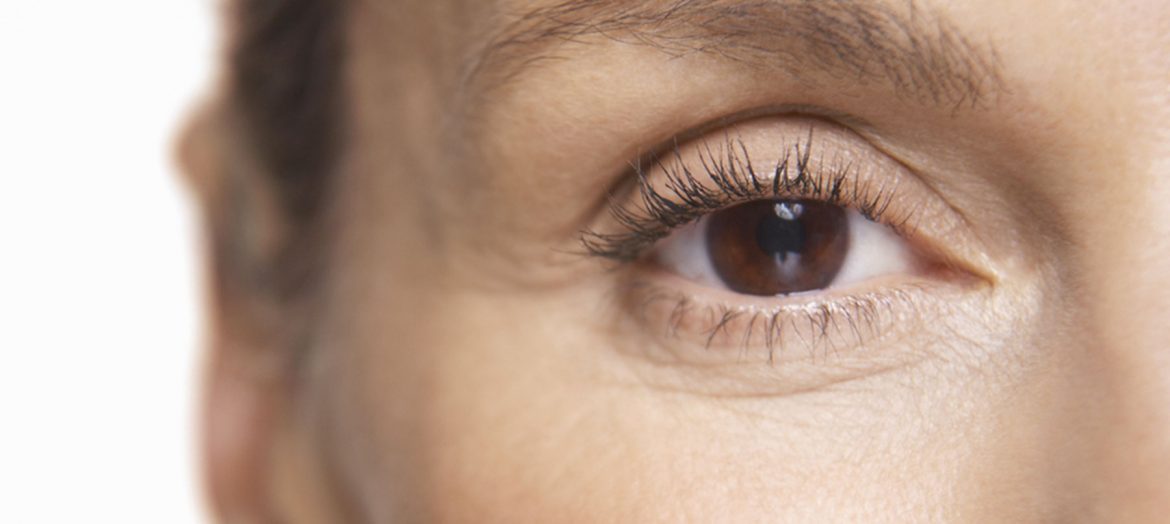 عادات يمكن أن تزيد من تجاعيد عينيك